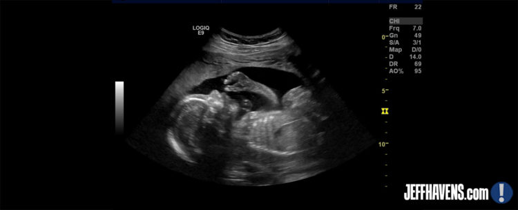 Jeff Havens Ultrasound