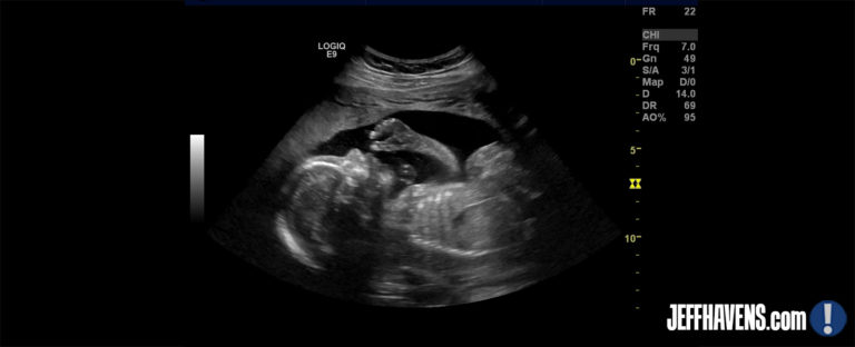 Jeff Havens Ultrasound